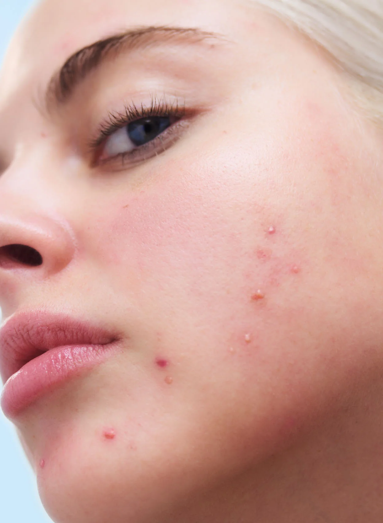 Acne Clarifying Cleanser - Image 3