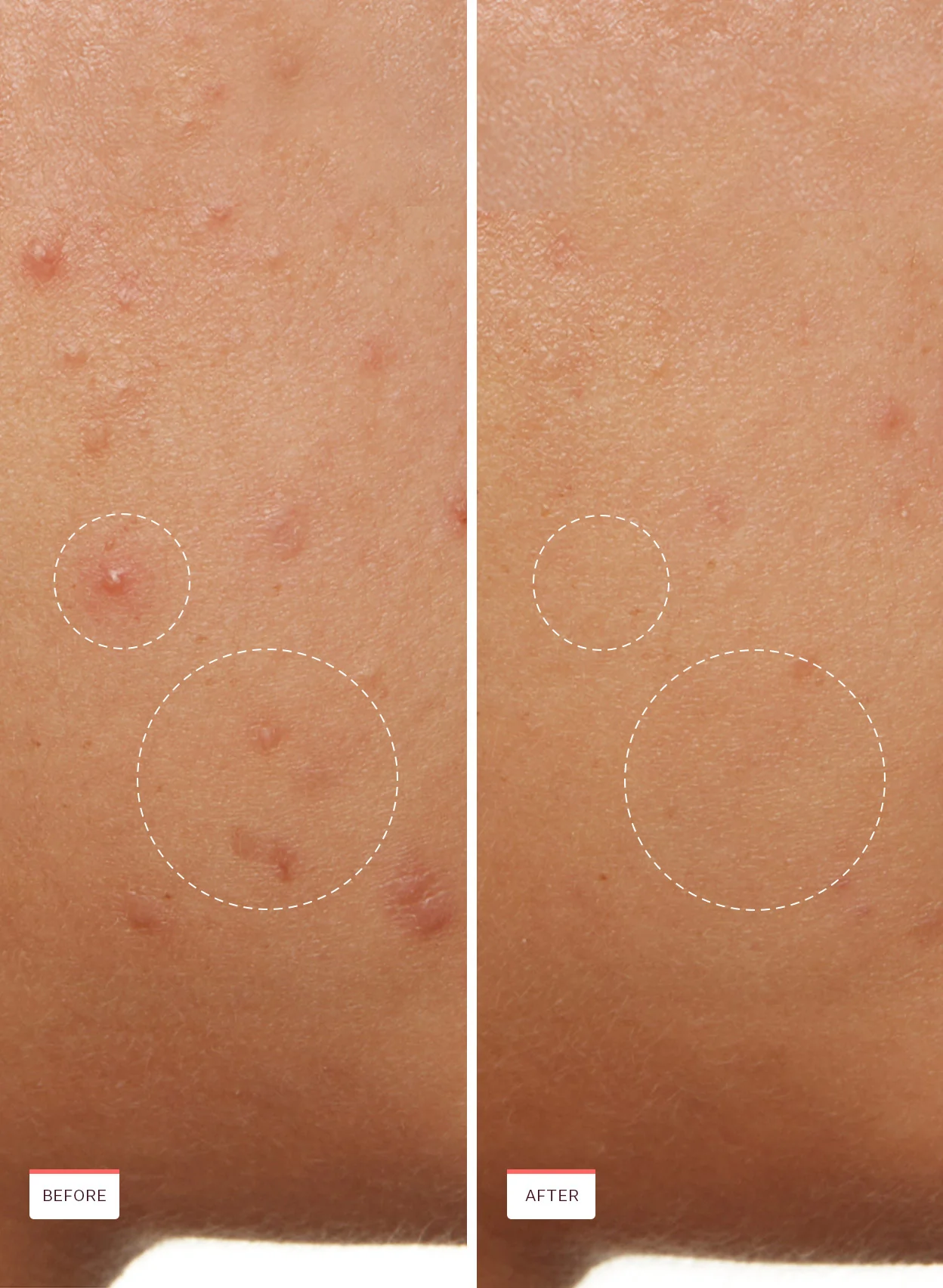 Acne Clarifying Cleanser - Image 7