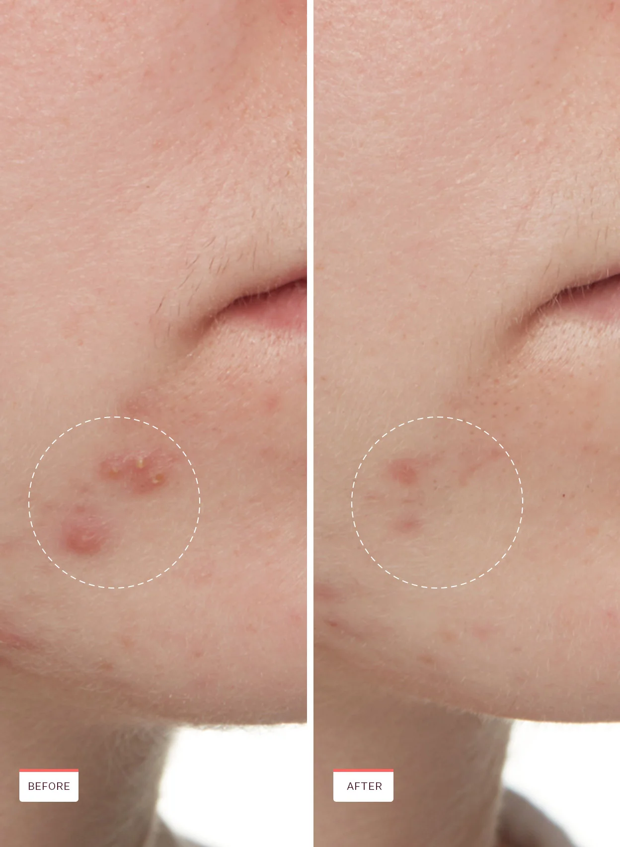 Acne Exfoliating Toner - Image 7