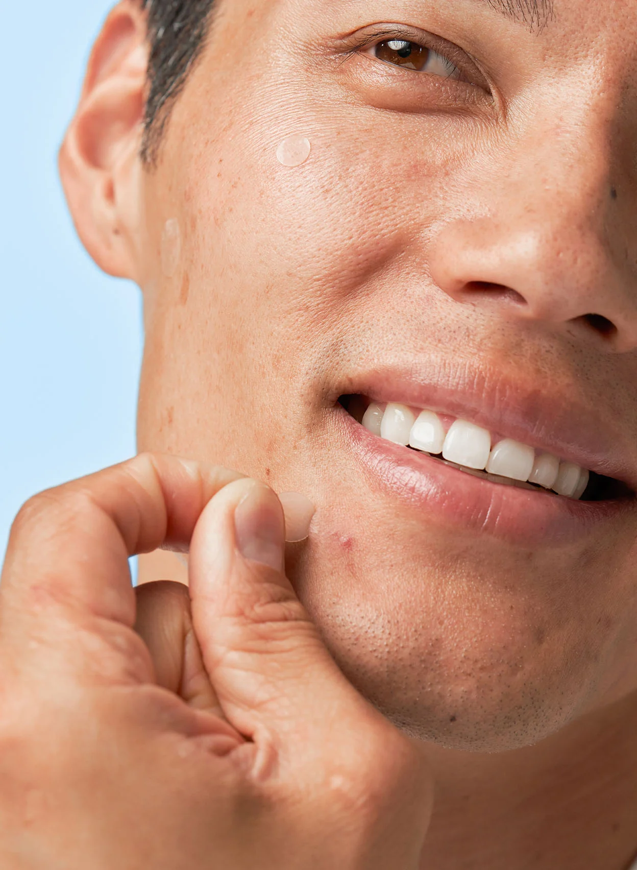 Acne Spot Treatment Trio - Image 3