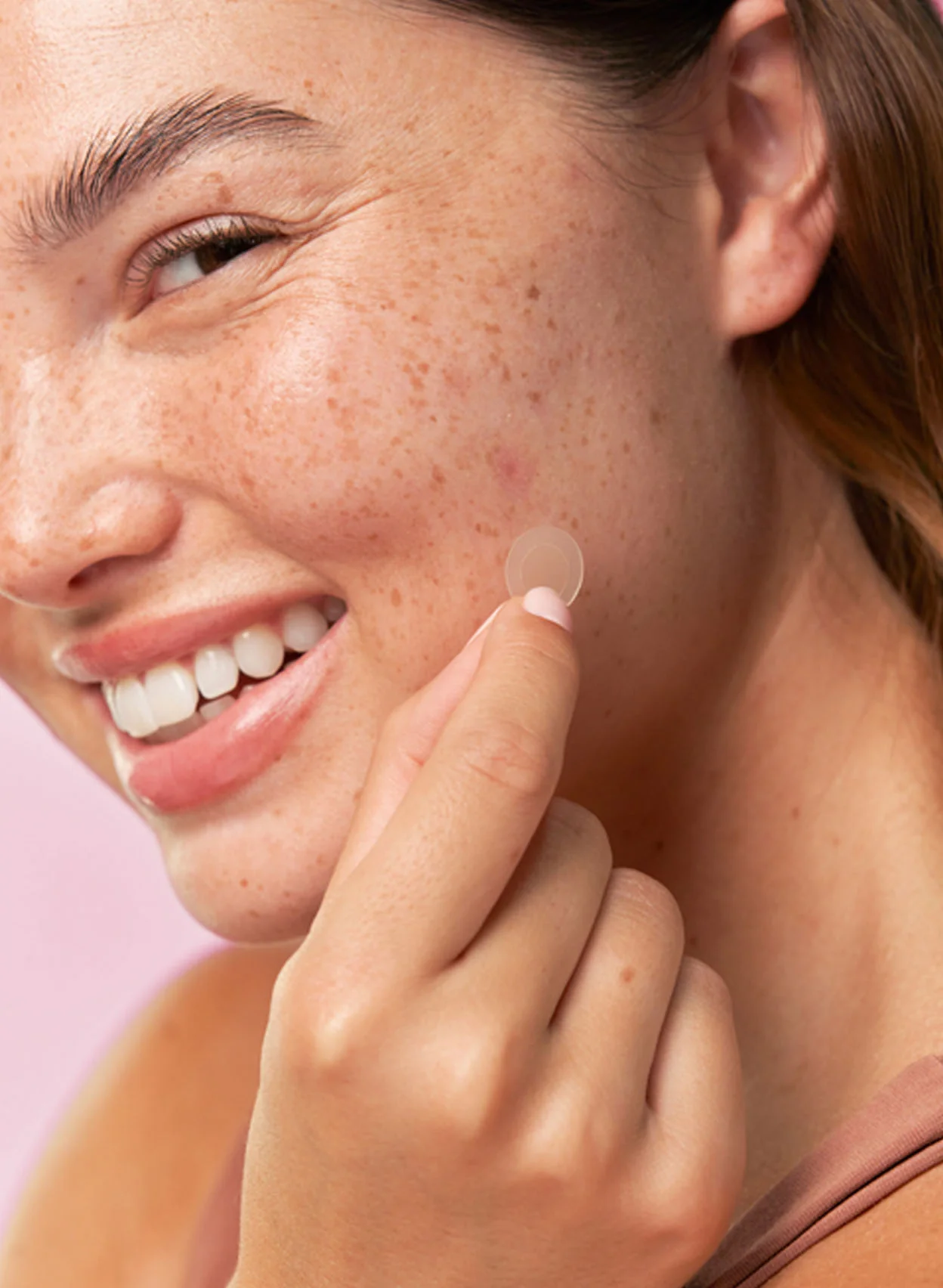 Acne Spot Treatment Trio - Image 5