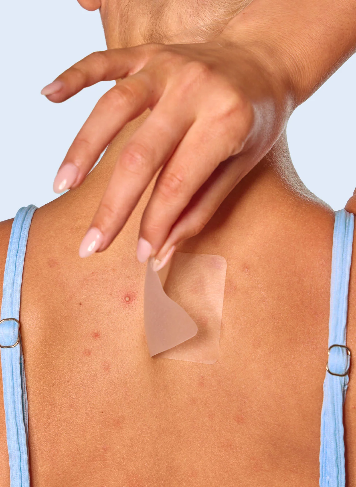 Body Breakout Patches - Image 3