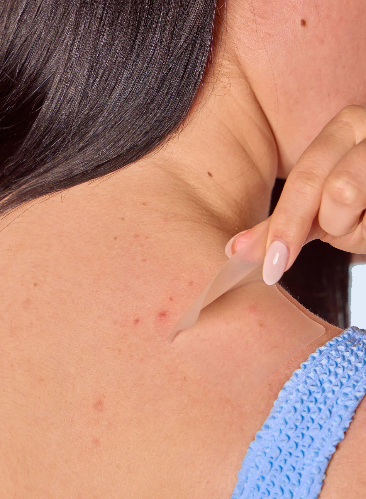 Body Breakout Patches - Image 5