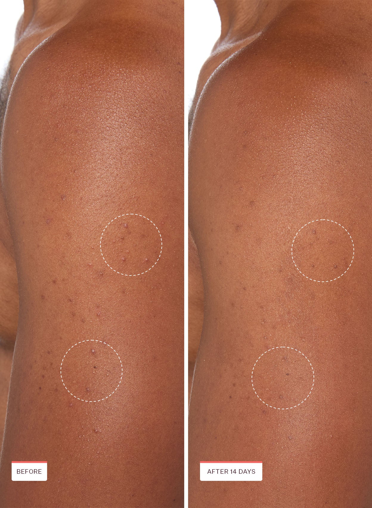 Body Breakout Patches - Image 7