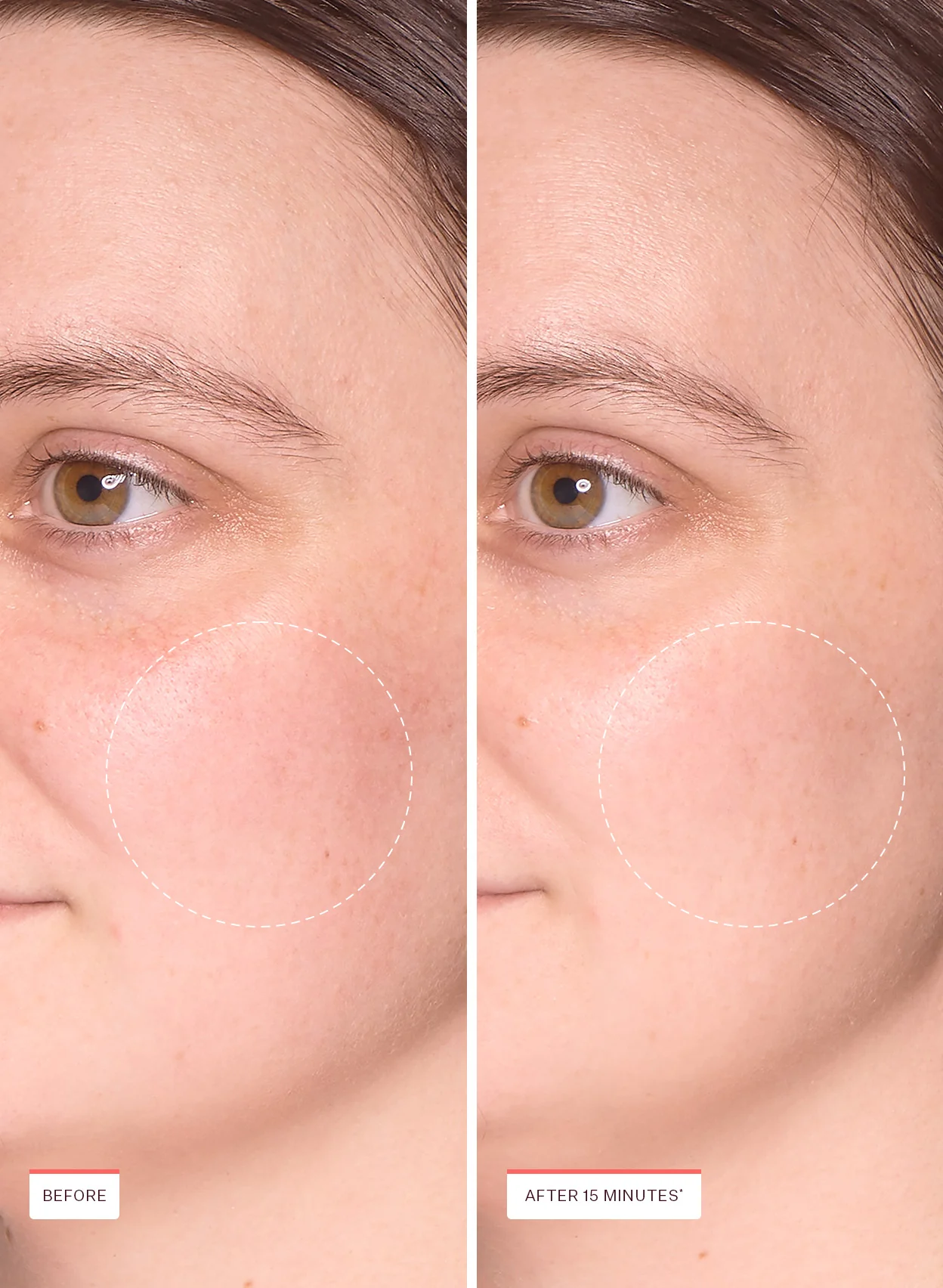 Cryo Reset Mask Pads - Image 5