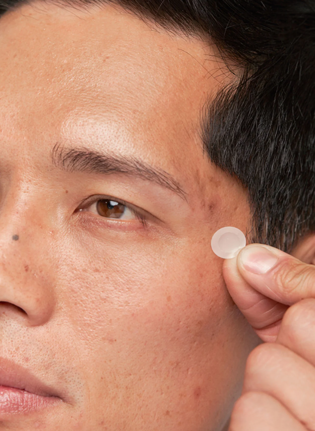 Deep Blemish Microdarts - Image 3