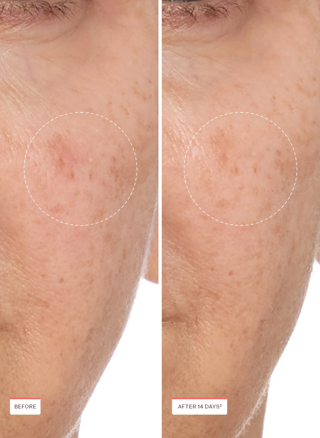 Glass Skin Luminous Kit - Image 6