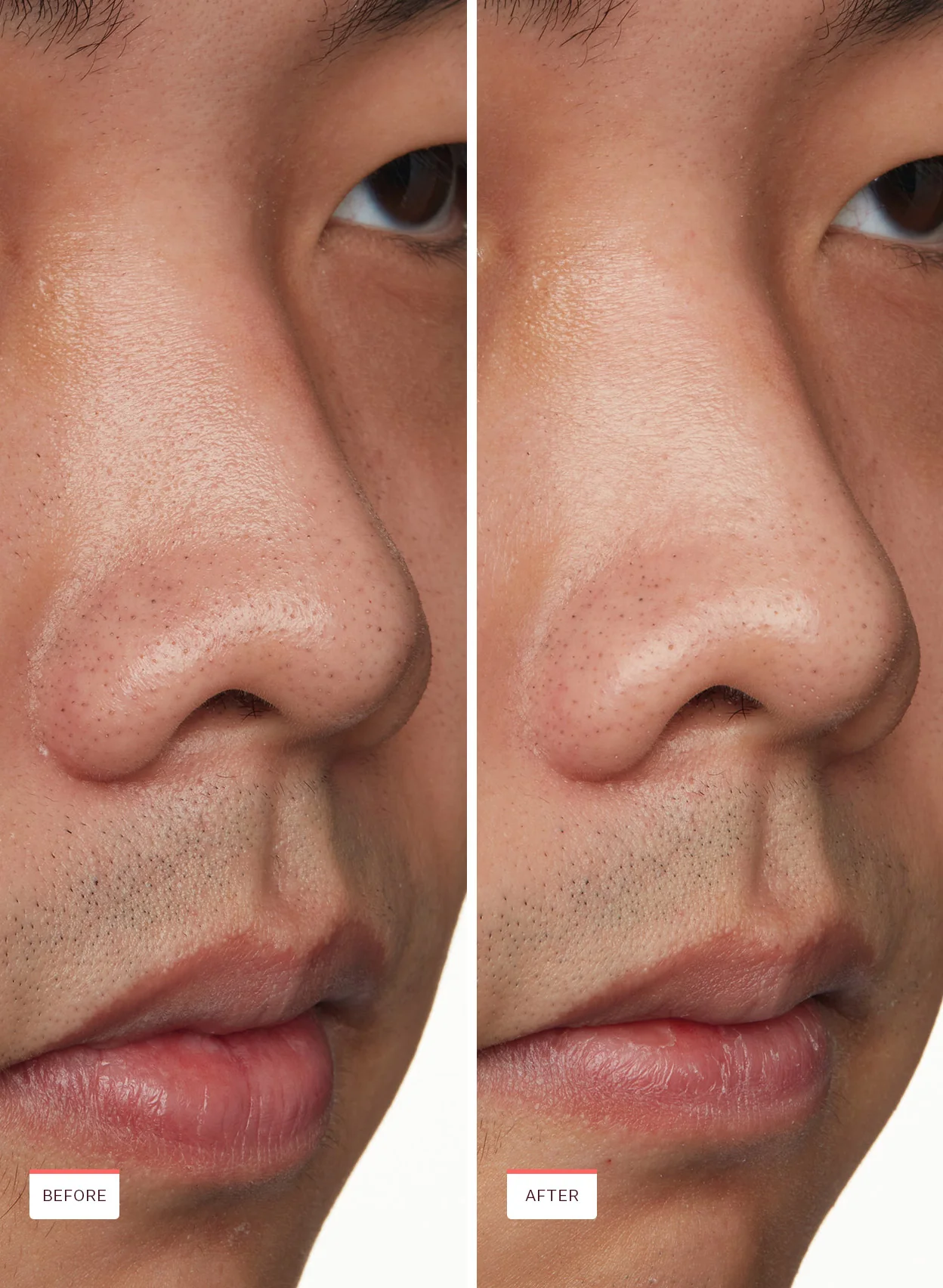 Nose Pore Patches - Image 7