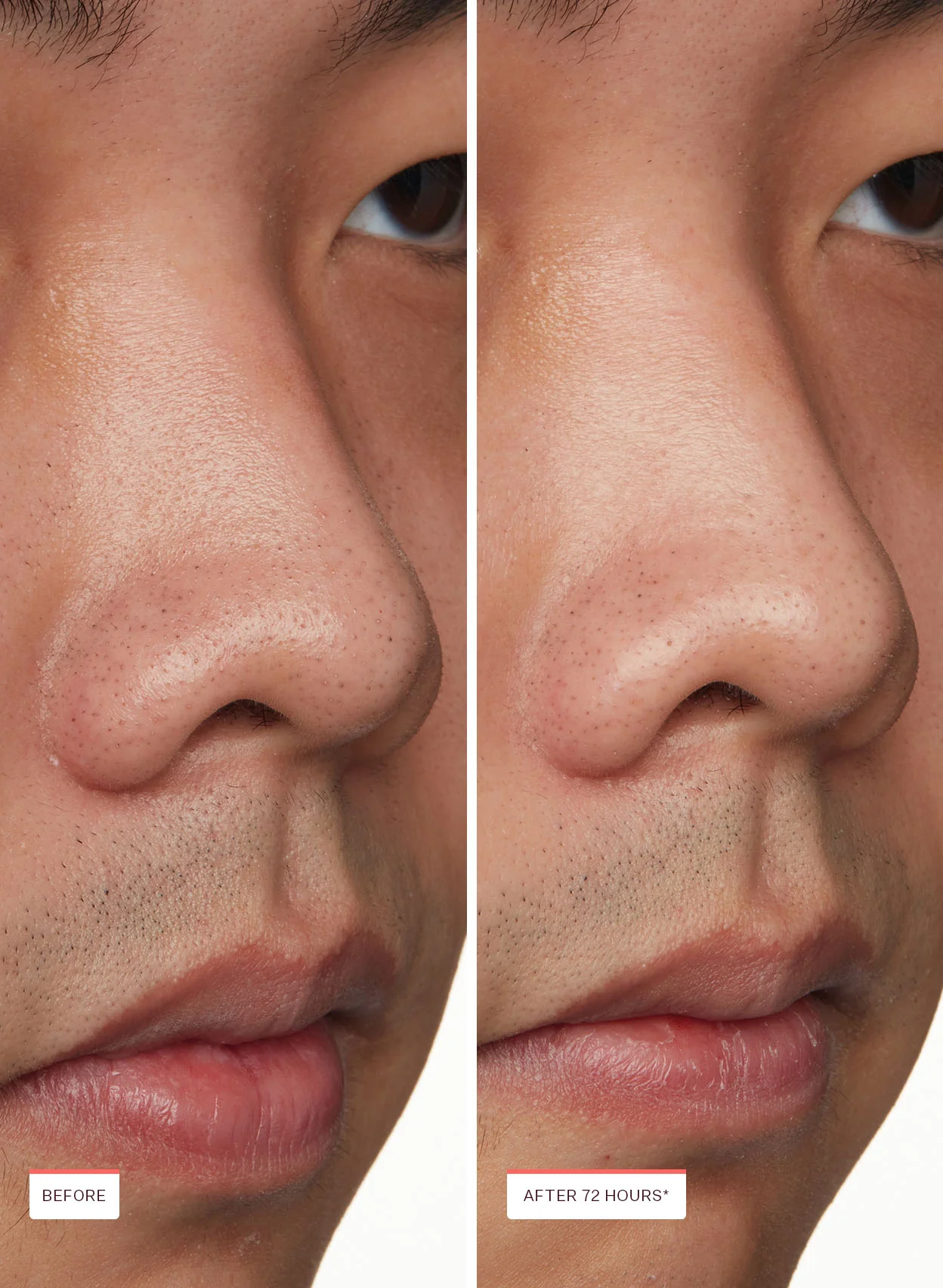 Pimple & Pore Patch Pack - Image 7