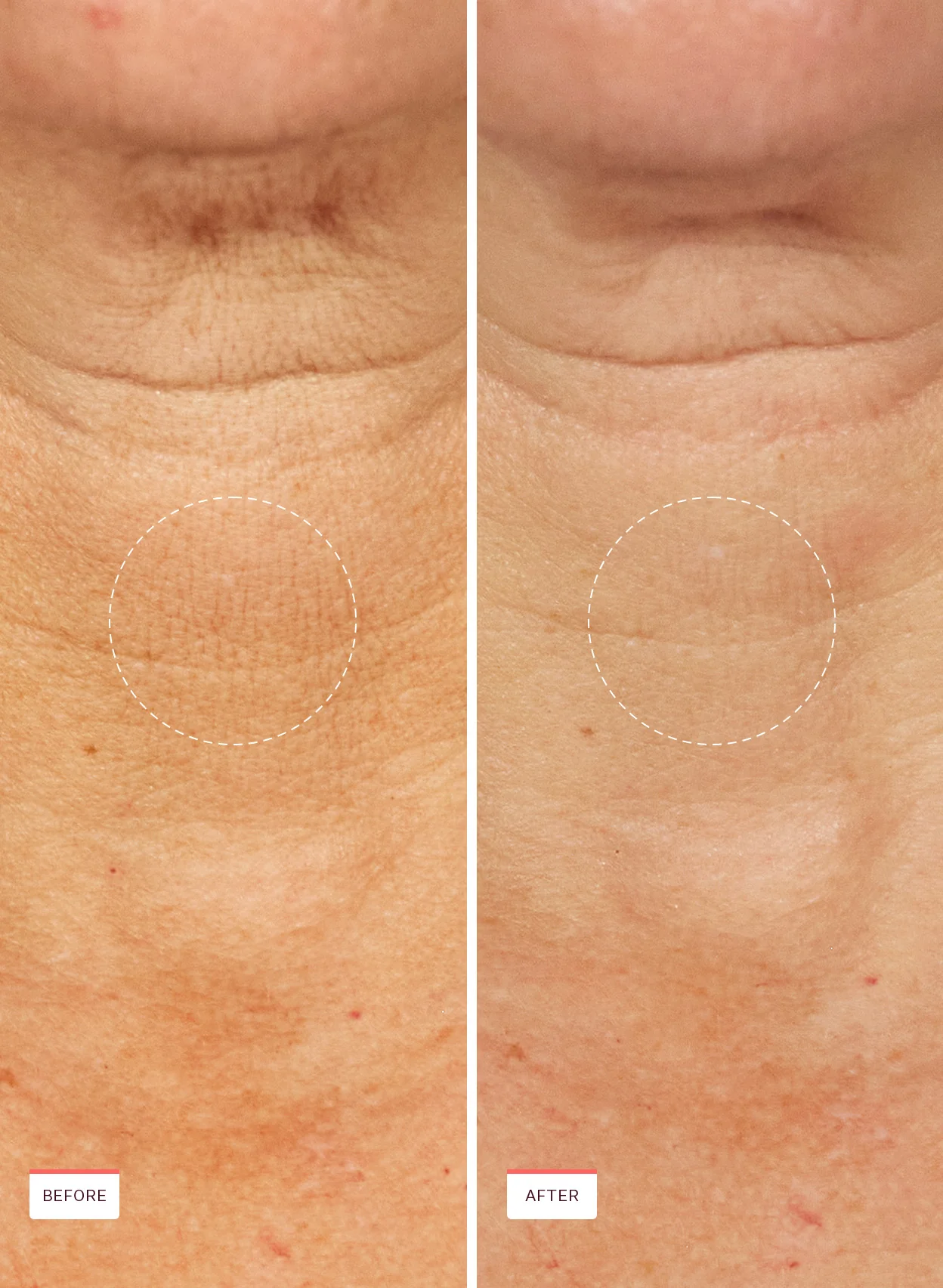 Power Cocktail Lactic Acid Repair Serum - Image 8