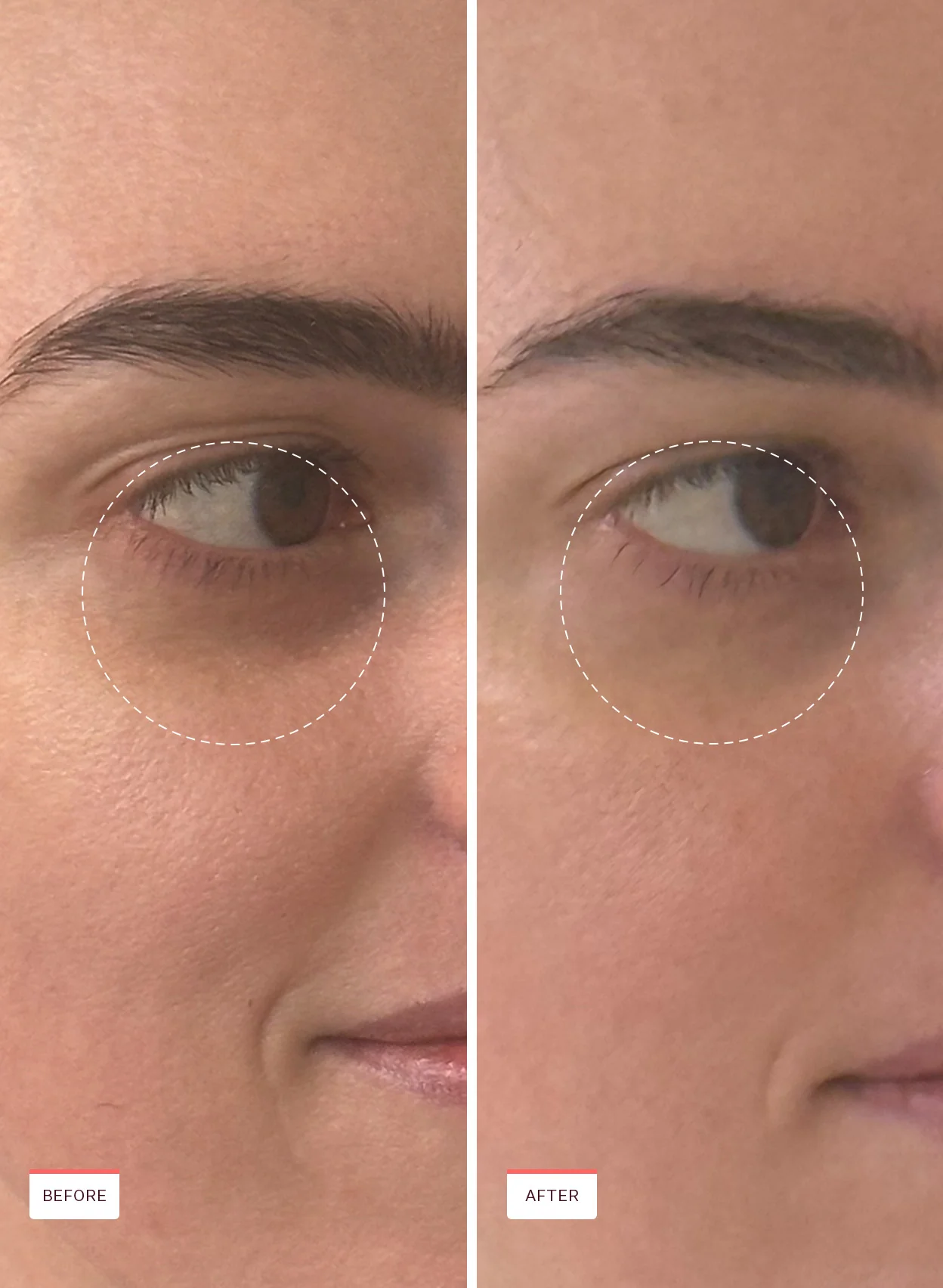 Pure Radiance Brightening Eye Cream - Image 3
