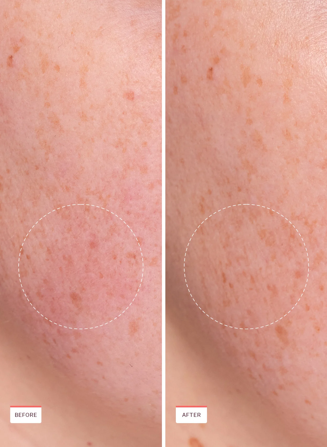 Rescue Party Barrier Restore Serum - Image 4