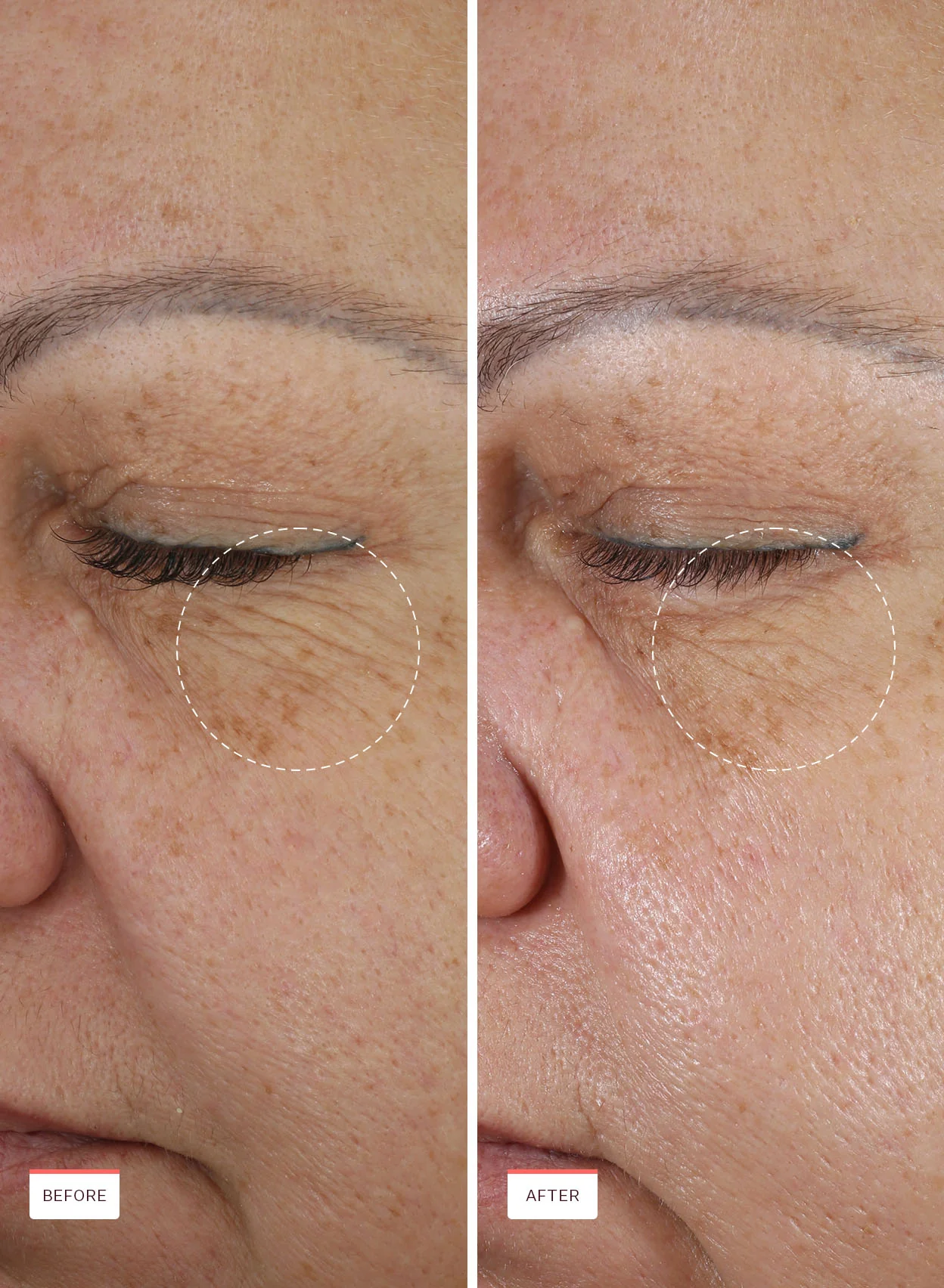 Retinal For All Renewing Serum - Image 4