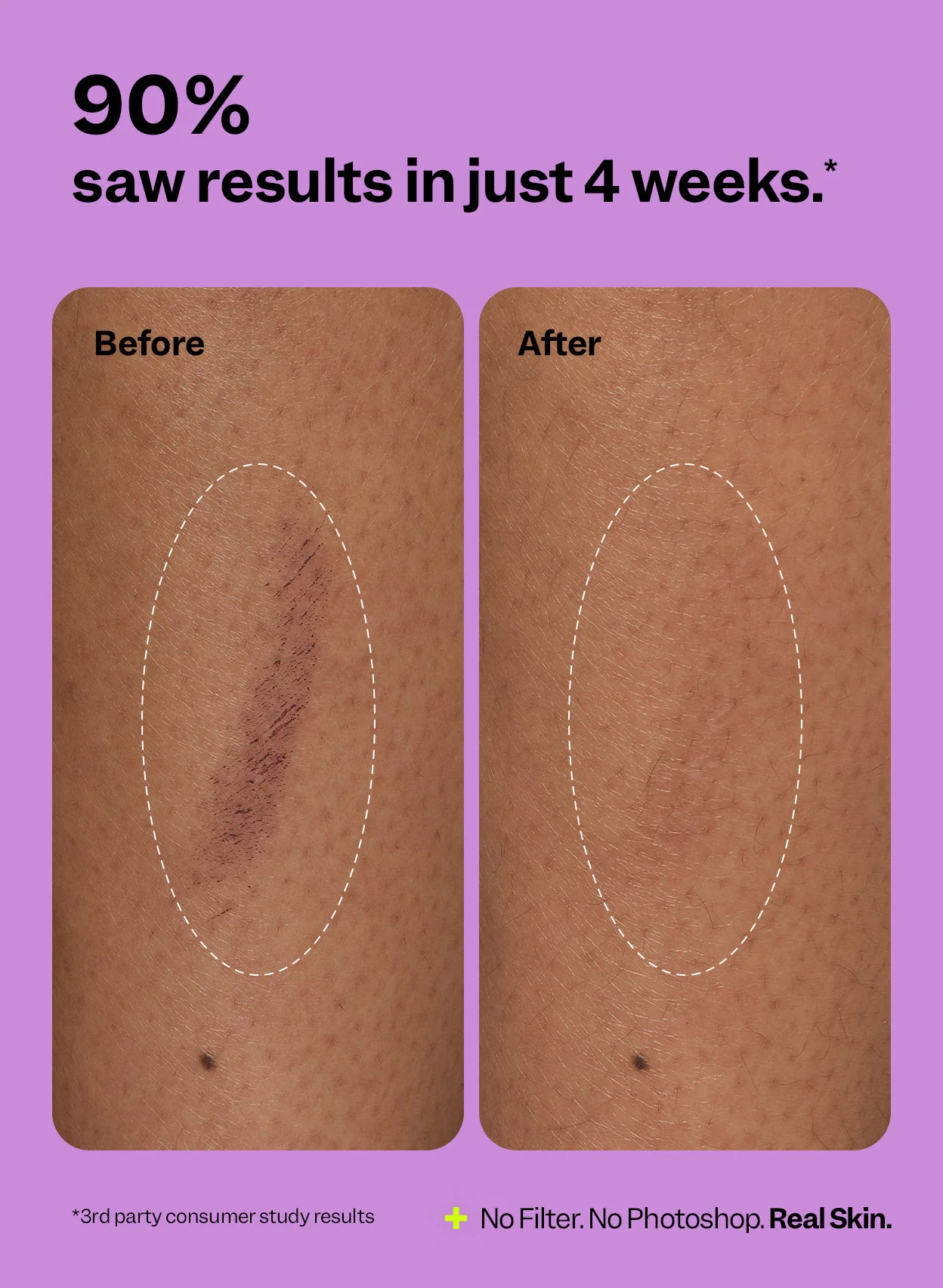 Scar Remedy Silicone Sheets - Image 3