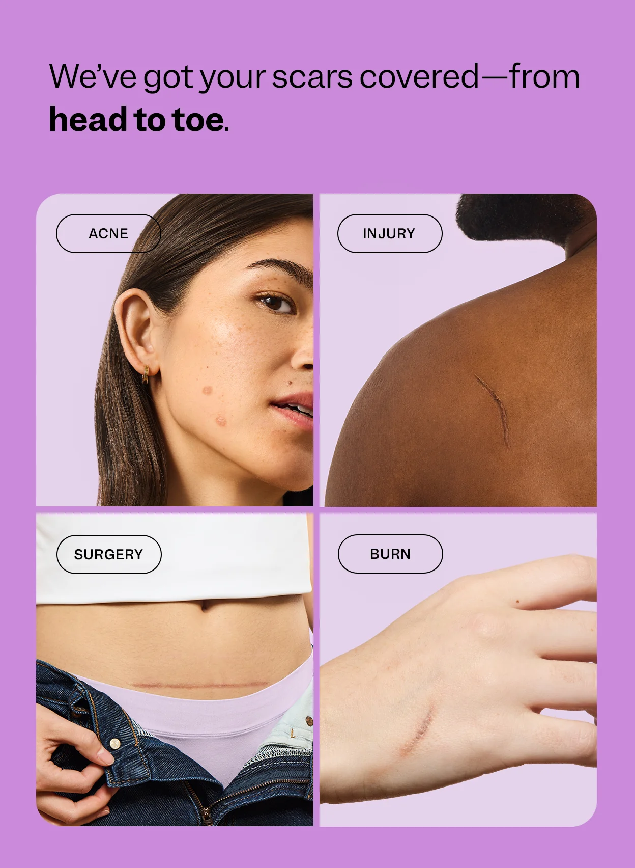 Scar Remedy Silicone Sheets - Image 7