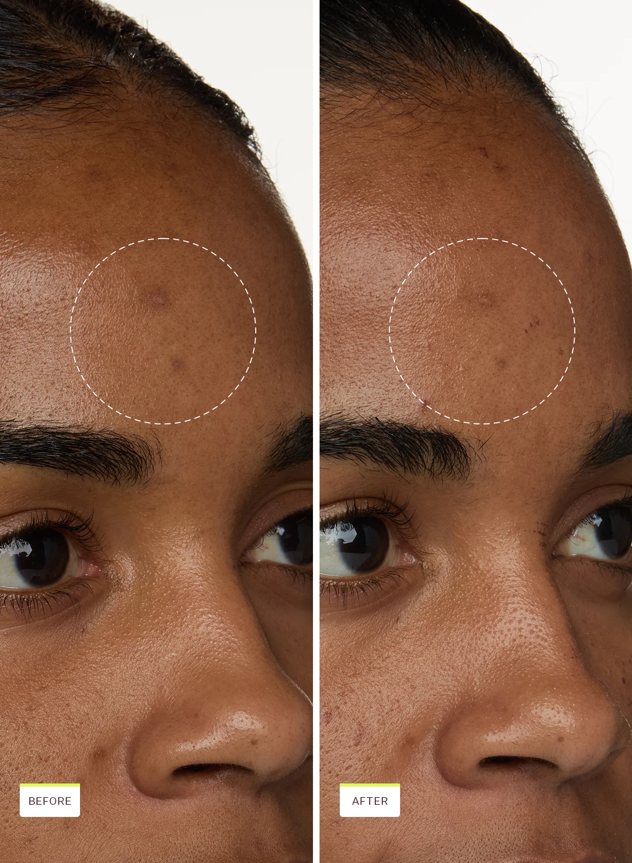 Super Fade Discoloration Duo - Image 6