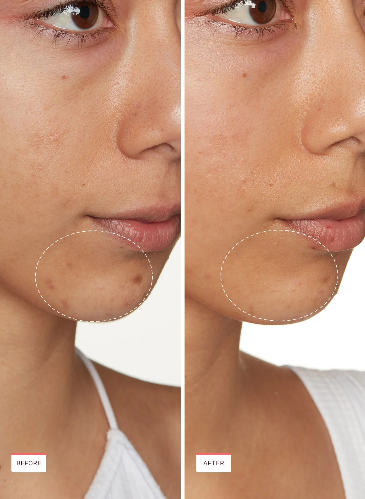 Transparen-C Pro Spot Treatment - Image 7